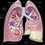 Mesothelioma asbestos cancer labs app for free