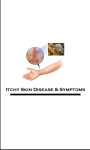 Itchy Skin Disease N Symptoms screenshot 1/3