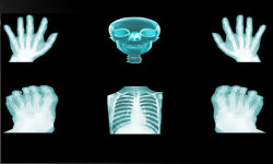 X-Ray Scanner -free screenshot 2/3