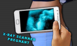 X Ray Scanner prank New App screenshot 2/6