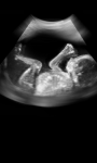 Ultrasound Scanner Prank screenshot 3/3