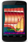 Cure for Atherosclerosis screenshot 1/3