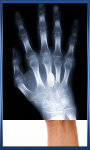 Human X Ray Scanner screenshot 2/6