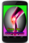 Cure for Osteoarthritis screenshot 1/3