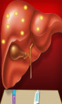 Liver Surgery Simulator screenshot 3/3